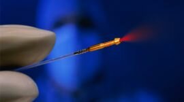 Лечение простатита лазером: эффективность и отзывы