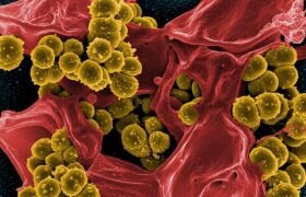 Бактериальный (инфекционный) простатит: признаки, причины и последствия