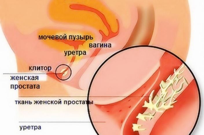 Женская простата: где находится железа Скина у женщин